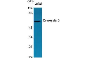 Western Blot (WB) analysis of specific cells using Cytokeratin 5 Polyclonal Antibody.