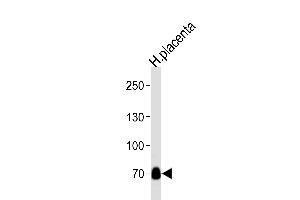Western blot analysis of lysate from human placenta tissue lysate, using NEK11L Antibody  (ABIN392646 and ABIN2842148).