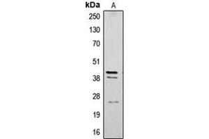 Western blot analysis of Cathepsin B expression in SW480 (A) whole cell lysates. (Cathepsin B anticorps  (Center))