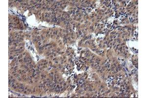 Image no. 2 for anti-Tripartite Motif Containing 38 (TRIM38) (AA 1-265) antibody (ABIN1490680) (TRIM38 anticorps  (AA 1-265))