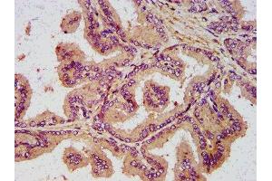 IHC image of ABIN7161105 diluted at 1:400 and staining in paraffin-embedded human prostate tissue performed on a Leica BondTM system.