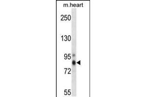 Western blot analysis in mouse heart tissue lysates (35ug/lane). (PKC eta anticorps  (AA 314-341))