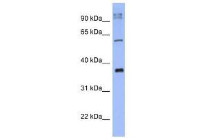 KCTD4 antibody used at 1 ug/ml to detect target protein. (KCTD4 anticorps  (N-Term))