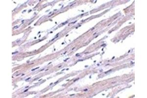 Image no. 1 for anti-Apoptotic Peptidase Activating Factor 1 (APAF1) (AA 12-28) antibody (ABIN319002) (APAF1 anticorps  (AA 12-28))