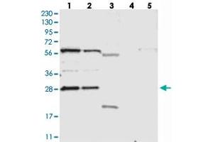 Western blot analysis of Lane 1: RT-4, Lane 2: U-251 MG, Lane 3: Human Plasma, Lane 4: Liver, Lane 5: Tonsil with PHOSPHO2 polyclonal antibody  at 1:250-1:500 dilution. (PHOSPHO2 anticorps)