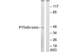 Western blot analysis of extracts from 293 cells, using p70 S6 Kinase beta (Ab-423) Antibody. (RPS6KB2 anticorps  (AA 389-438))