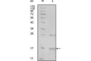 TNK1 anticorps  (AA 451-560)