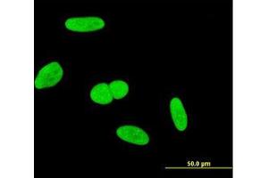 anti-Integrator Complex Subunit 6 (INTS6) (AA 779-888) antibody