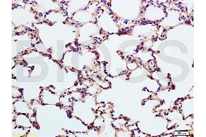 Formalin-fixed and paraffin embedded rat lung labeled with Anti-SP-D PSPD Polyclonal Antibody, unconjugated (ABIN731678) at 1:200, followed by incubation with conjugated secondary antibody and DAB staining.
