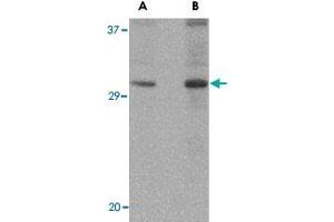 Western blot analysis of DNAL1 in NIH/3T3 cell lysate with DNAL1 polyclonal antibody  at (A) 1 and (B) 2 ug/mL . (DNAL1 anticorps  (C-Term))