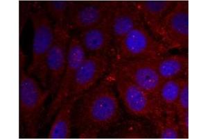 Image no. 2 for anti-Synuclein, alpha (SNCA) (pTyr136) antibody (ABIN401576) (SNCA anticorps  (pTyr136))