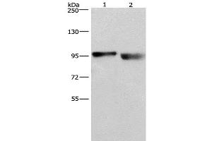 Western Blot analysis of A431 and lovo cell using KIAA1524 Polyclonal Antibody at dilution of 1:597 (KIAA1524 anticorps)