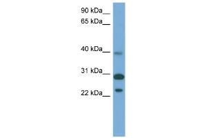 WB Suggested Anti-CCDC28A Antibody Titration: 0. (CCDC28A anticorps  (Middle Region))