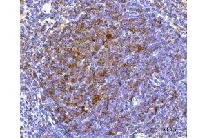 IHC analysis of NCR1 using anti-NCR1 antibody (ABIN7602013).
