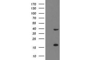 Western Blotting (WB) image for anti-PDZ and LIM Domain 2 (PDLIM2) antibody (ABIN1500125) (PDLIM2 anticorps)