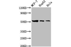 Western Blot Positive WB detected in: MCF-7 whole cell lysate, HepG2 whole cell lysate, Hela whole cell lysate All lanes: GBA antibody at 3. (GBA anticorps  (AA 215-343))