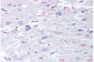 Anti-CYSLTR2 / CYSLT2 antibody  ABIN1048490 IHC staining of human heart. (CasLTR2 anticorps  (C-Term))