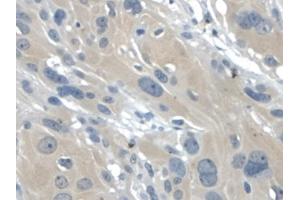 IHC-P analysis of Human Esophagus, with DAB staining. (Galectin 2 anticorps  (AA 1-132))