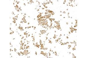 Immunocytochemistry (ICC) image for anti-Metadherin (MTDH) (AA 475-525) antibody (ABIN7795651)