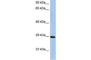 WB Suggested Anti-CRYBA1 Antibody Titration: 0. (CRYBA1 anticorps  (N-Term))