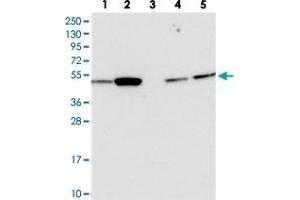 Western blot analysis of Lane 1: RT-4, Lane 2: U-251 MG, Lane 3: Human Plasma, Lane 4: Liver, Lane 5: Tonsil with ATF7IP2 polyclonal antibody  at 1:250-1:500 dilution.