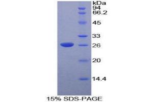 SDS-PAGE (SDS) image for Deoxyribonuclease I-Like 2 (DNASE1L2) (AA 32-229) protein (His tag) (ABIN1878854) (DNASE1L2 Protein (AA 32-229) (His tag))