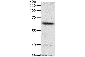 Western blot analysis of Mouse heart tissue, using FZD4 Polyclonal Antibody at dilution of 1:200 (FZD4 anticorps)