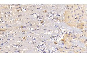 Detection of MAP1B in Mouse Cerebrum Tissue using Polyclonal Antibody to Microtubule Associated Protein 1B (MAP1B)