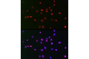 Immunofluorescence analysis of NIH/3T3 cells using CTBP2 Rabbit mAb (ABIN7265979) at dilution of 1:100 (40x lens). (CTBP2 anticorps)