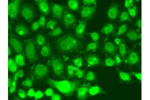 Immunofluorescence analysis of A549 cells using TSEN2 antibody. (TSEN2 anticorps)