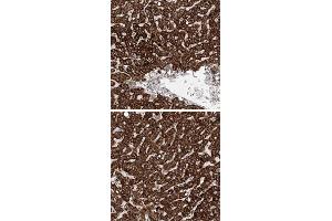 Immunohistochemical staining of human liver with PKHD1 polyclonal antibody  shows strong cytoplasmic positivity in hepatocytes. (PKHD1 anticorps)