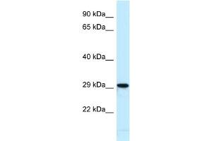 Host:  Rabbit  Target Name:  Nfic  Sample Type:  Mouse Heart lysates  Antibody Dilution:  1. (NFIC anticorps  (N-Term))