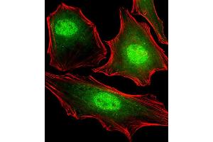 Fluorescent image of Hela cells stained with FUBP3 Antibody (N-term) B. (FUBP3 anticorps)