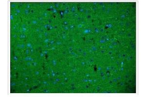 IF analysis of Alpha Internexin/INA using anti-Alpha Internexin/INA antibody (ABIN7602187). (INA anticorps  (AA 62-169))