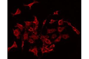 ABIN6267406 staining Hela by IF/ICC. (Stathmin 1 anticorps  (pSer38))
