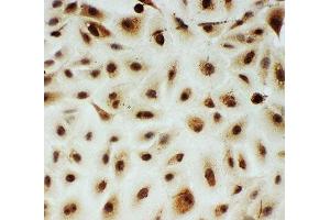 ICC testing of MYBL2 antibody and A549 cells