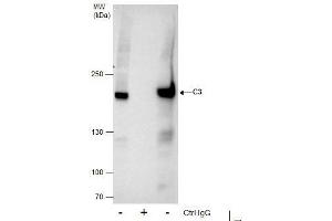 IP Image Immunoprecipitation of C3 protein from HepG2 whole cell extracts using 5 μg of C3 antibody [C3], C-term, Western blot analysis was performed using C3 antibody [C3], C-term, EasyBlot anti-Rabbit IgG  was used as a secondary reagent. (C3 anticorps  (C-Term))