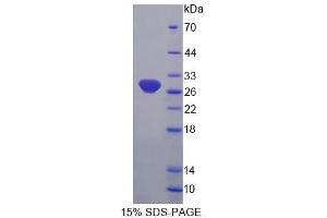 SDS-PAGE analysis of Human FBL Protein.