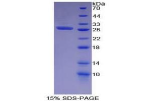 SDS-PAGE analysis of Mouse EGFR2 Protein. (EGFR2 Protéine)