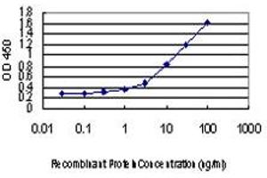 Detection limit for recombinant GST tagged RAD18 is approximately 0.