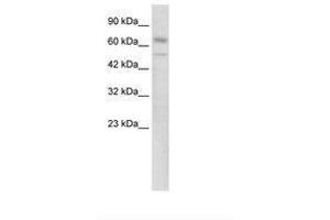 Image no. 1 for anti-Zinc Finger Protein 306 (ZKSCAN3) (N-Term) antibody (ABIN6735863) (ZKSCAN3 anticorps  (N-Term))
