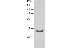 Western Blotting (WB) image for Retinol Binding Protein 5, Cellular (RBP5) (AA 1-135) protein (His tag) (ABIN7286832) (Retinol Binding Protein 5 Protein (AA 1-135) (His tag))
