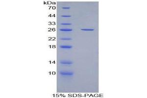 SDS-PAGE (SDS) image for CD200 (CD200) (AA 31-232) protein (His tag) (ABIN1879166) (CD200 Protein (CD200) (AA 31-232) (His tag))