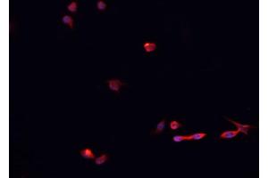 ABIN6266661 staining HeLa  cells by IF/ICC. (SUMO1 anticorps  (N-Term))