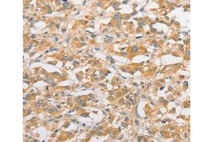 Immunohistochemistry (IHC) image for anti-Toll-Like Receptor 5 (TLR5) antibody (ABIN2422735) (TLR5 anticorps)