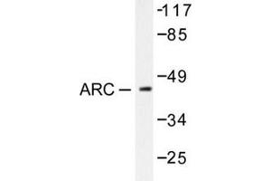 Image no. 2 for anti-Cadherin 1, Type 1, E-Cadherin (Epithelial) (CDH1) (Arg3) antibody (ABIN265314) (E-cadherin anticorps  (Arg3))