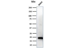 Western Blot Analysis of HeLa cell lysate using NME1 / nm23-H1 Mouse Monoclonal Antibody (CPTC-NME1-2). (NME1 anticorps)