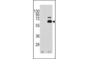 Western blot analysis of RPS6KB1 (arrow) using rabbit polyclonal RPS6KB1 Antibody  (R). (RPS6KB1 anticorps  (AA 405-434))