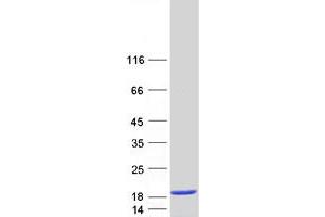 Validation with Western Blot