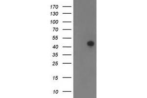 Western Blotting (WB) image for anti-Tropomodulin 1 (TMOD1) antibody (ABIN1501529) (Tropomodulin 1 anticorps)